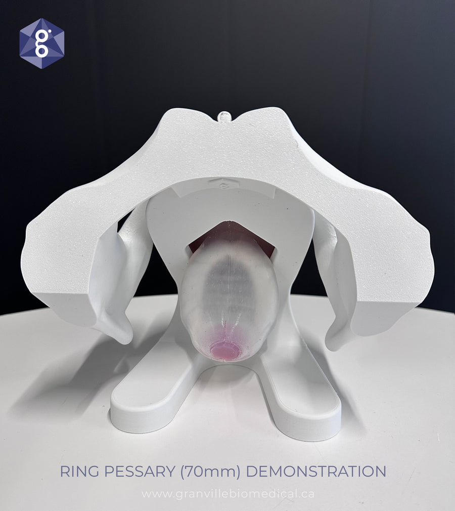 Iris™ Pessary & Device Demonstration Model – Granville Biomedical Inc.