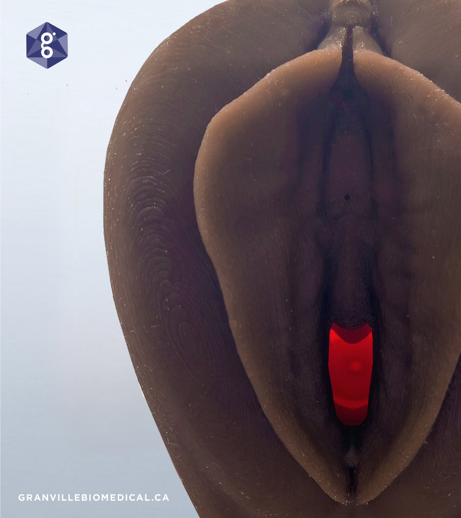 Dark Venus Pelvic Health Anatomical Model with close up of cervix